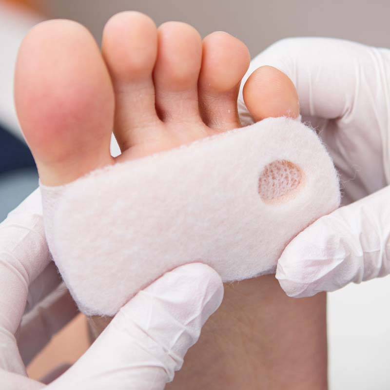 Diabetic Foot Ulcer Study